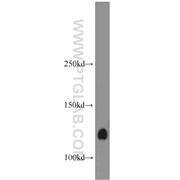 CNOT3 Rabbit Polyclonal Antibody (11135-1-AP)