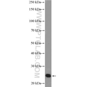 PSMB4 Rabbit Polyclonal Antibody (11029-1-AP)