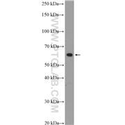 FUBP3 Rabbit Polyclonal Antibody (10623-1-AP)