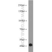 DAG1 Rabbit Polyclonal Antibody (11017-1-AP)