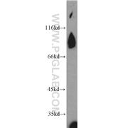 REC8 Rabbit Polyclonal Antibody (10793-1-AP)