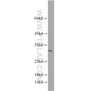 YEATS4 Rabbit Polyclonal Antibody (11050-1-AP)