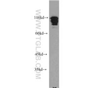 HNRNPUL1 Rabbit Polyclonal Antibody (10578-1-AP)
