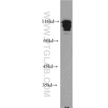 HNRNPUL1 Rabbit Polyclonal Antibody (10578-1-AP)