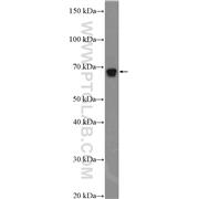 NF2 Rabbit Polyclonal Antibody (10659-1-AP)