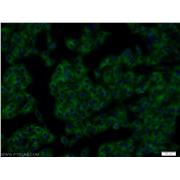 RTN4 Rabbit Polyclonal Antibody (10950-1-AP)