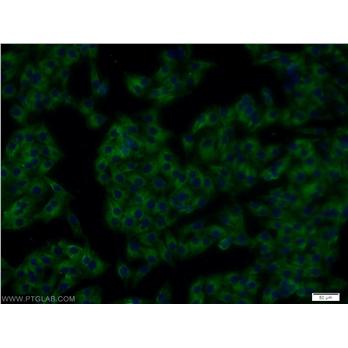 RTN4 Rabbit Polyclonal Antibody (10950-1-AP)