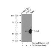 NONO Rabbit Polyclonal Antibody (11058-1-AP)