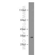 IGFBP2 Rabbit Polyclonal Antibody (11065-3-AP)