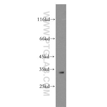 IGFBP2 Rabbit Polyclonal Antibody (11065-3-AP)