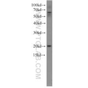 NRAS Rabbit Polyclonal Antibody (10724-1-AP)