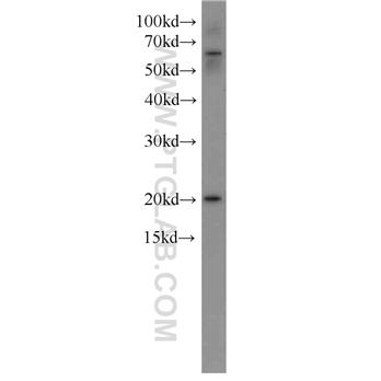 NRAS Rabbit Polyclonal Antibody (10724-1-AP)