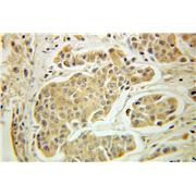 GTPBP3 Rabbit Polyclonal Antibody (10764-1-AP)
