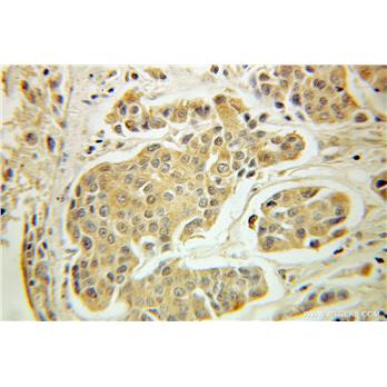 GTPBP3 Rabbit Polyclonal Antibody (10764-1-AP)