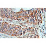 AMD1 Rabbit Polyclonal Antibody (11052-1-AP)