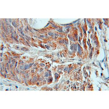 AMD1 Rabbit Polyclonal Antibody (11052-1-AP)