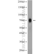 CXCR4 Rabbit Polyclonal Antibody (11073-2-AP)