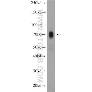 CXCR4 Rabbit Polyclonal Antibody (11073-2-AP)