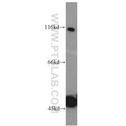 HPS3 Rabbit Polyclonal Antibody (10768-1-AP)