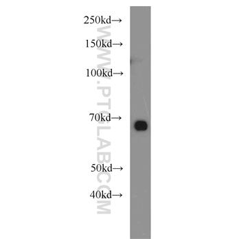 GATA2 Rabbit Polyclonal Antibody (11103-1-AP)