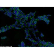 DENR Rabbit Polyclonal Antibody (10656-1-AP)
