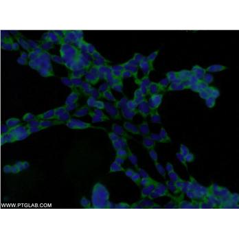 DENR Rabbit Polyclonal Antibody (10656-1-AP)