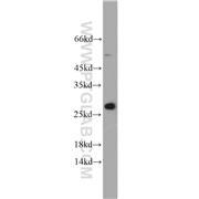 MESDC2 Rabbit Polyclonal Antibody (10958-1-AP)