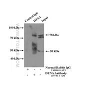 DTNA Rabbit Polyclonal Antibody (10741-1-AP)