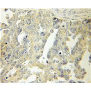 RPSA Rabbit Polyclonal Antibody (10668-1-AP)