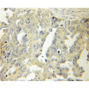 RPSA Rabbit Polyclonal Antibody (10668-1-AP)