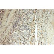 PSAP Rabbit Polyclonal Antibody (10801-1-AP)