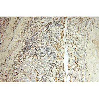 PSAP Rabbit Polyclonal Antibody (10801-1-AP)