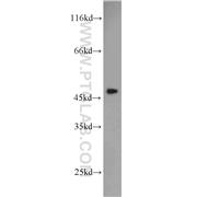 SERPINH1 Rabbit Polyclonal Antibody (10875-1-AP)