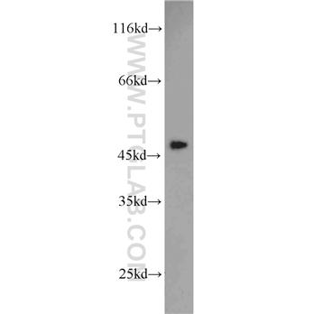 SERPINH1 Rabbit Polyclonal Antibody (10875-1-AP)