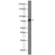 MECP2 Rabbit Polyclonal Antibody (10861-1-AP)