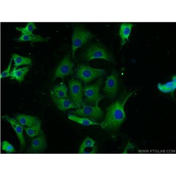 MAP2K2 Rabbit Polyclonal Antibody (11049-1-AP)