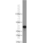 STK11 Rabbit Polyclonal Antibody (10746-1-AP)