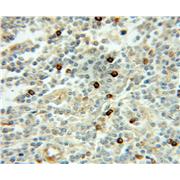 UBE2A Rabbit Polyclonal Antibody (11080-1-AP)