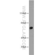KAT5 Rabbit Polyclonal Antibody (10827-1-AP)