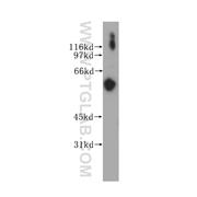 PEX14 Rabbit Polyclonal Antibody (10594-1-AP)