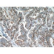 SERPINA5 Rabbit Polyclonal Antibody (10673-1-AP)