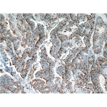 SERPINA5 Rabbit Polyclonal Antibody (10673-1-AP)