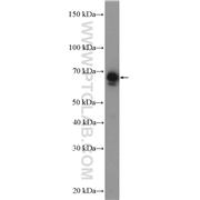RPN2 Rabbit Polyclonal Antibody (10576-1-AP)