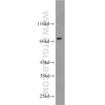 DPP3 Rabbit Polyclonal Antibody (10650-1-AP)
