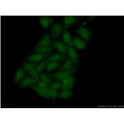 MBIP Rabbit Polyclonal Antibody (10685-1-AP)