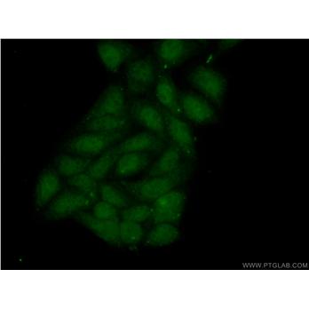 MBIP Rabbit Polyclonal Antibody (10685-1-AP)