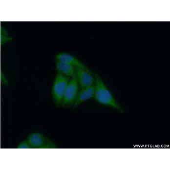 APOL4 Rabbit Polyclonal Antibody (10564-1-AP)