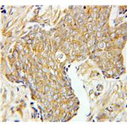 CLTA Rabbit Polyclonal Antibody (10852-1-AP)