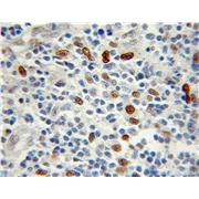 TKT Rabbit Polyclonal Antibody (11039-1-AP)