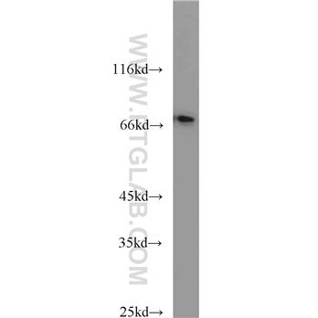 CD24 Rabbit Polyclonal Antibody (10600-1-AP)